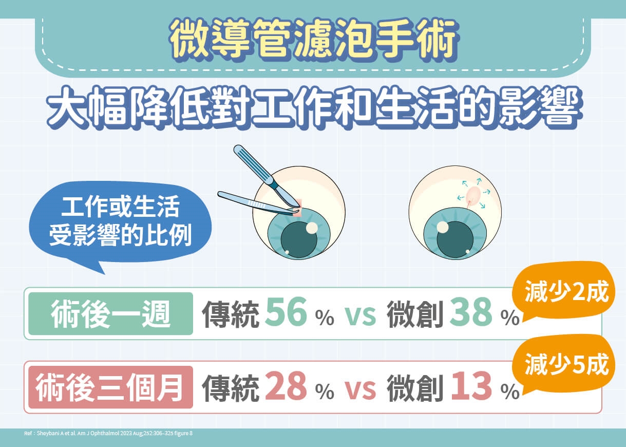 青光眼治療新趨勢：微創手術免住院、恢復快！數週快速回歸精彩生活