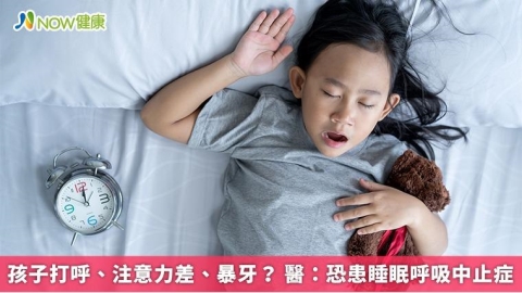 孩子打呼、注意力差、暴牙? 醫:恐患睡眠呼吸中止症