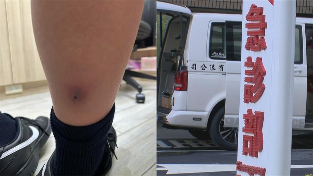 12歲男童感冒退燒又高燒！醫掀褲管驚覺「1警訊」速轉急診：ICU住3天