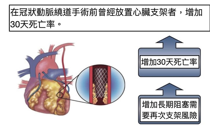 先放心臟支架再做繞道手術風險升高 長庚研究籲調整治療策略