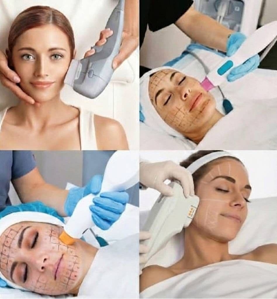 韓星權珉娥做醫美險毀容！醫揭電音波「舒眠麻醉」危機與防雷3關鍵