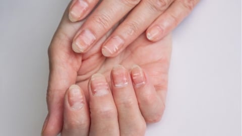 養甲懶人包!營養師解析4大與指甲健康相關的營養素