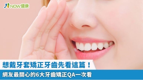想戴牙套矯正牙齒先看這篇! 網友最關心的6大牙齒矯正QA一次看