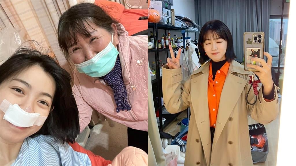 米可白燒聲賣餅被問「隆鼻手術還好嗎？」她嚇歪自清：沒有動工過