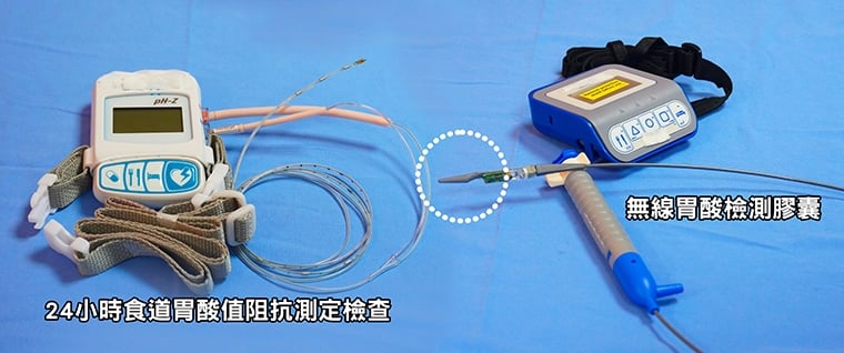 難治型胃食道逆流難根治？ 採一療法有助擺脫藥物依賴