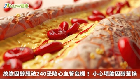總膽固醇飆破240恐陷心血管危機! 小心壞膽固醇惹禍