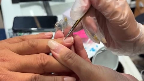 指甲易斷、有紋路竟是「身體的3大警訊」?醫曝補救「必吃菜單」