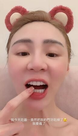 短今突PO「門牙缺一角」近距離照！竟是「吃飯吃進肚」…她崩潰喊：要瘋了