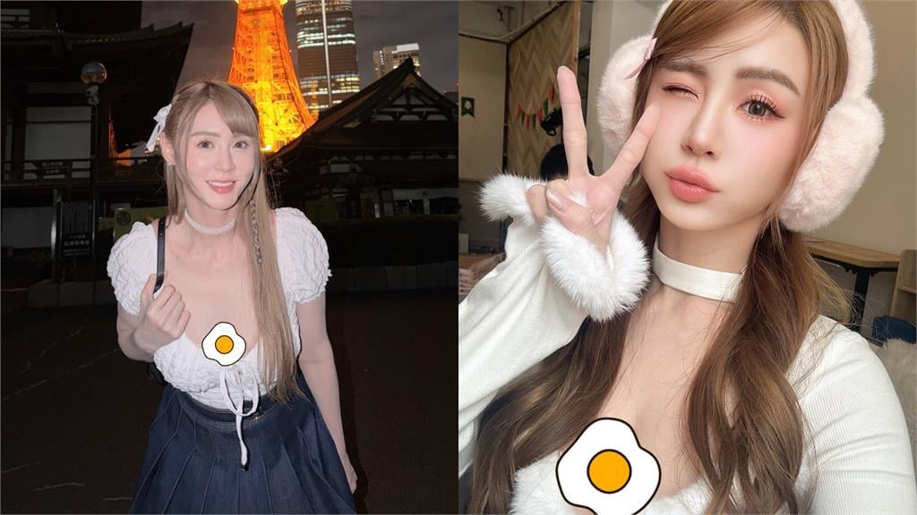 短今突PO「門牙缺一角」近距離照！竟是「吃飯吃進肚」…她崩潰喊：要瘋了