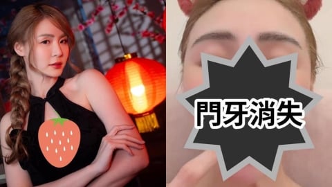 短今突PO「門牙缺一角」近距離照！竟是「吃飯吃進肚」…她崩潰喊：要瘋了
