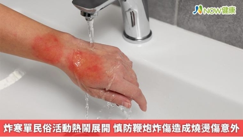 炸寒單民俗活動熱鬧展開 慎防鞭炮炸傷造成燒燙傷意外