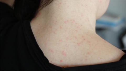 皮膚癢總是好不了?慢性搔癢的3大關鍵 醫:正確照護最重要