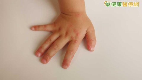 腸病毒重症添2例！國中生手腳無力住ICU　未滿5歲童腦炎搶救中