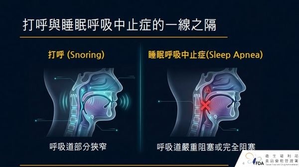 打呼不順要當心！「睡眠呼吸中止症」戴呼吸器睡覺？醫揭使用前必知事項