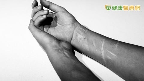 孩子不開門、不上學只是叛逆？揭青少年憂鬱症「4大求救警訊」