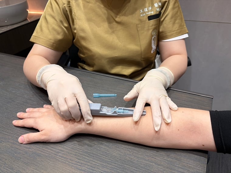 上班族久坐低頭肌肉筋膜易受傷 浮針療法緩解肩頸背痛