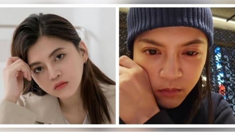 葉欣眉才動手術又出事！誤把口角炎藥粉當眼藥水　瞬間痛到變「血輪眼」