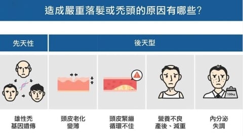 雄性禿植髮後悔潮？雄性禿治療失敗：醫師曝3大關鍵!