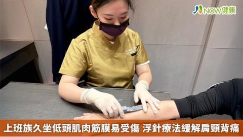 上班族久坐低頭肌肉筋膜易受傷 浮針療法緩解肩頸背痛