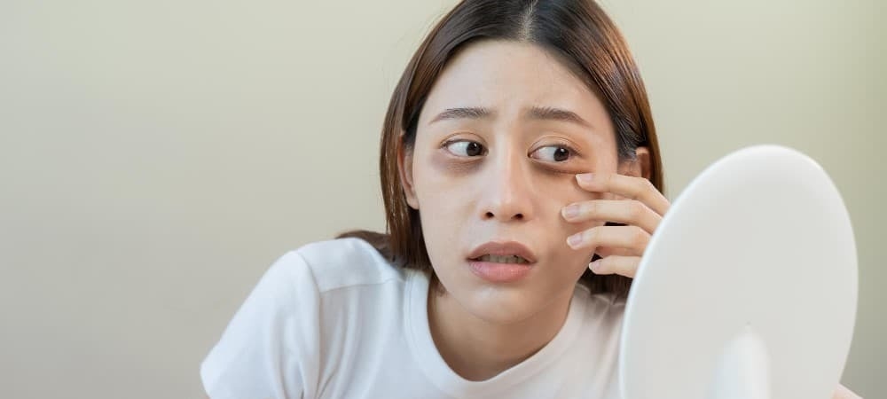 20歲就有淚溝黑眼圈？ 醫揭「熊貓針」席捲Z世代主因