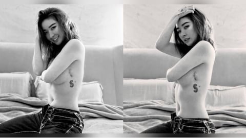 婦女節首曬「術後疤痕照」　許維恩堅強喊：每一道都是人生勳章