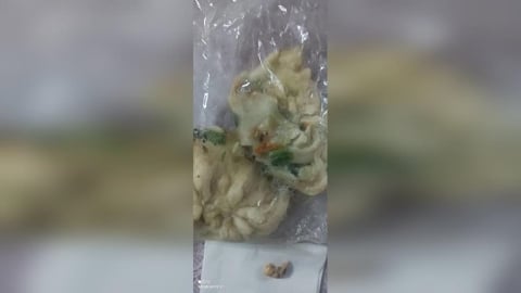 人肉水煎包？民眾一咬內餡驚見「牙齒」　台東衛生局回應了