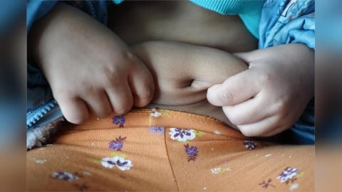 小時胖不是胖？小心一路胖到大！「兒童5肥胖原因」一次看，醫揭「4招」帶孩子遠離肥胖！