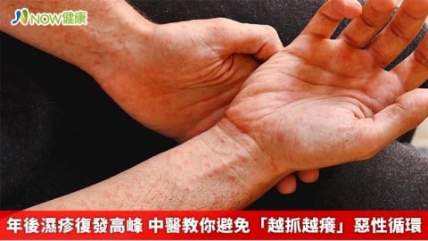 年後濕疹復發高峰 中醫教你避免「越抓越癢」惡性循環