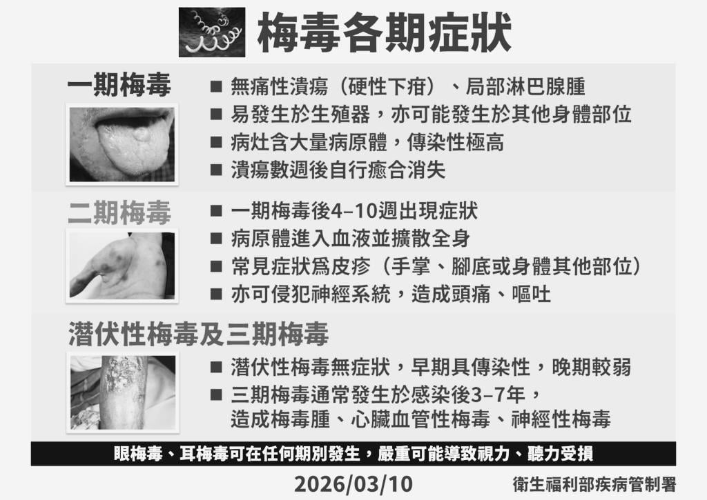 「15至24歲」染疫梅毒暴增8%！疾管署：72小時「黃金救援期」錯過恐傷神經