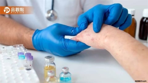 休假回越南！女交換生纏綿男友　回台發現「染梅毒」