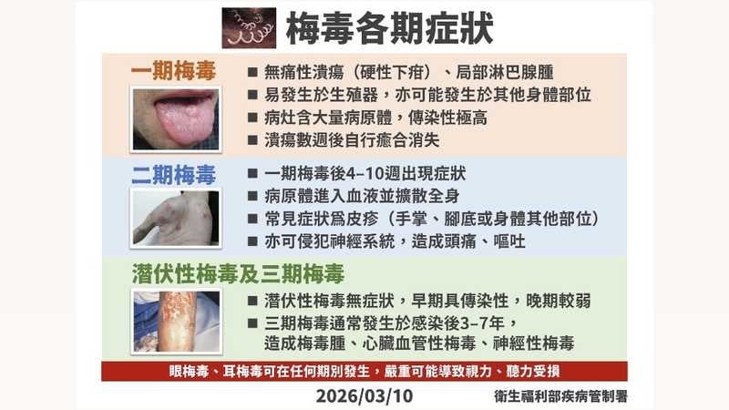 15至24歲去年梅毒確診數增近2千例　疾管署揭主因並籲善用1資源