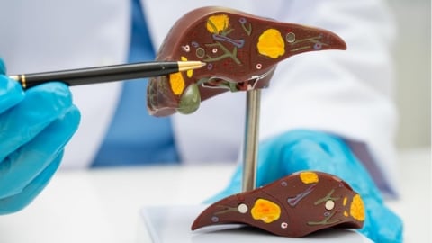 台灣脂肪肝人口超過3成！治療希望竟是 「瘦瘦筆」？ 醫證實：有望改善肝纖維化