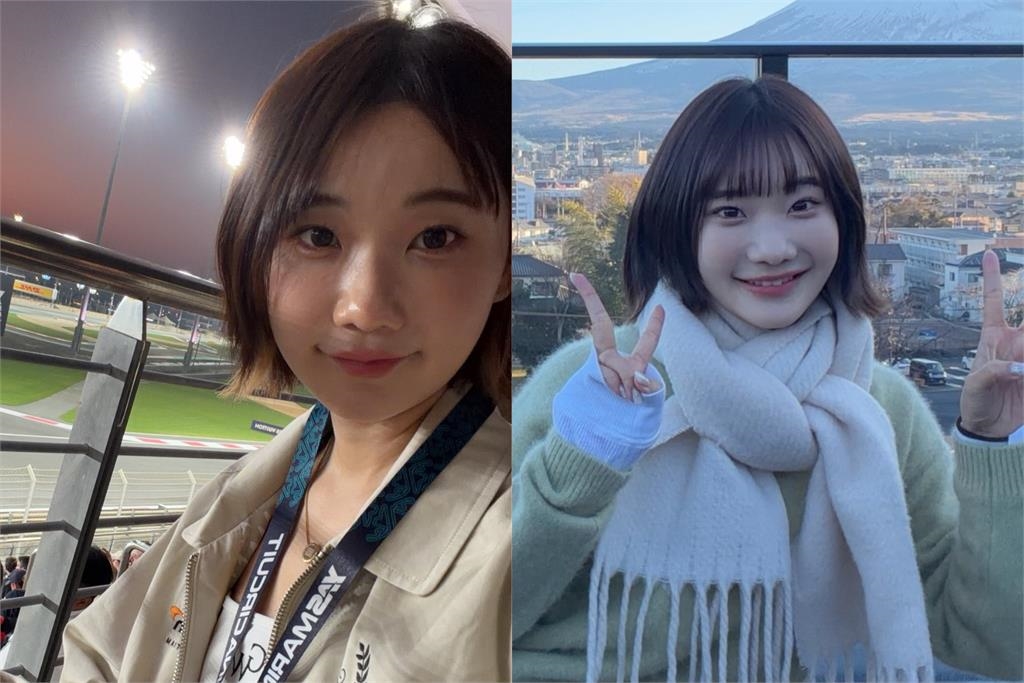 愛莉莎莎自爆動「雙眼皮手術」！模樣竟「撞臉胡瓜」嘆：整個皮膚都在腫