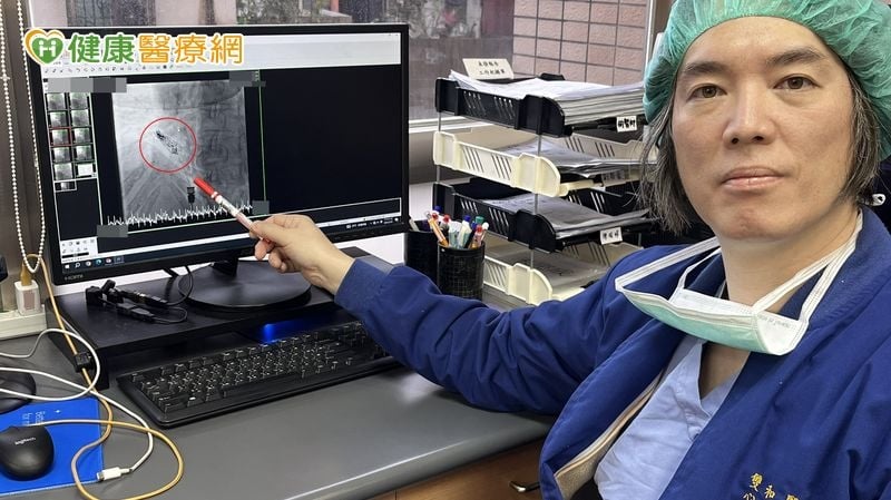 76歲婦人一動就喘竟是病竇症候群　無導線心臟節律器救回一命