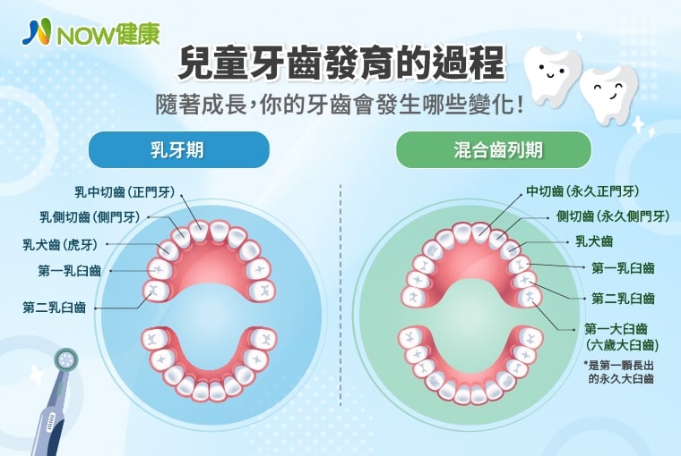 兒童矯正不拔牙有黃金期 這年齡階段及早評估重塑齒列