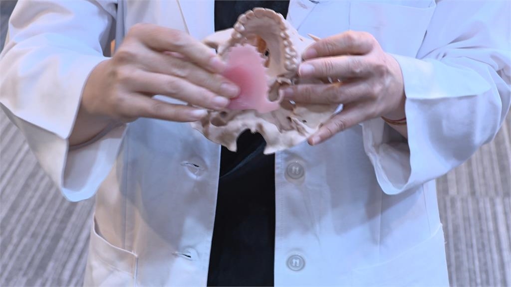 長庚3D列印製作「數位閉孔器」　助患者擺脫鼻胃管人生