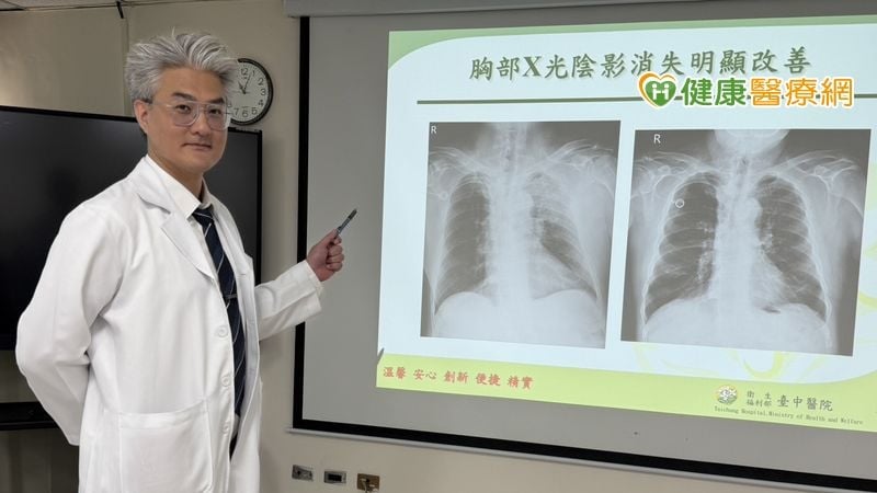 七旬翁確診極惡性淋巴癌　醫列6大警示症狀