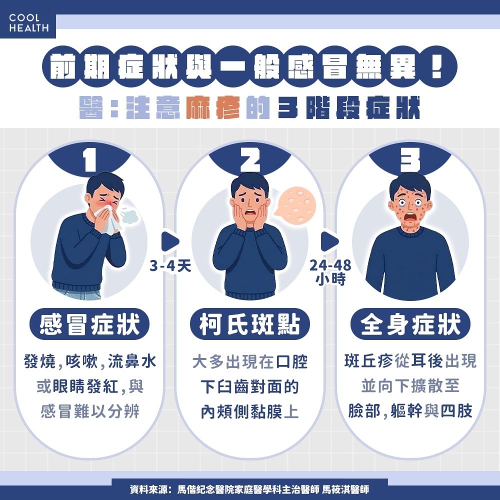 前期症狀與一般感冒無異&nbsp; 如何知道自己是否感染麻疹？