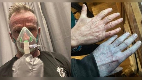 一覺睡醒變成《阿凡達》！　他嚇到衝醫院檢查...結局竟是烏龍一場