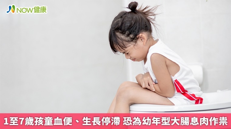 1至7歲孩童血便、生長停滯 恐為幼年型大腸息肉作祟