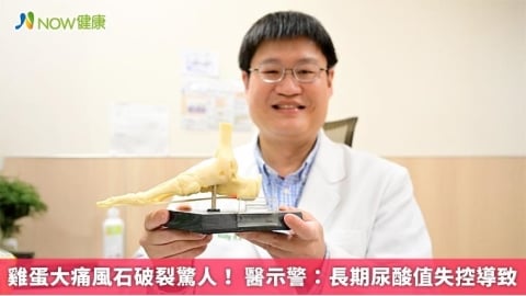 雞蛋大痛風石破裂驚人！ 醫示警：長期尿酸值失控導致 