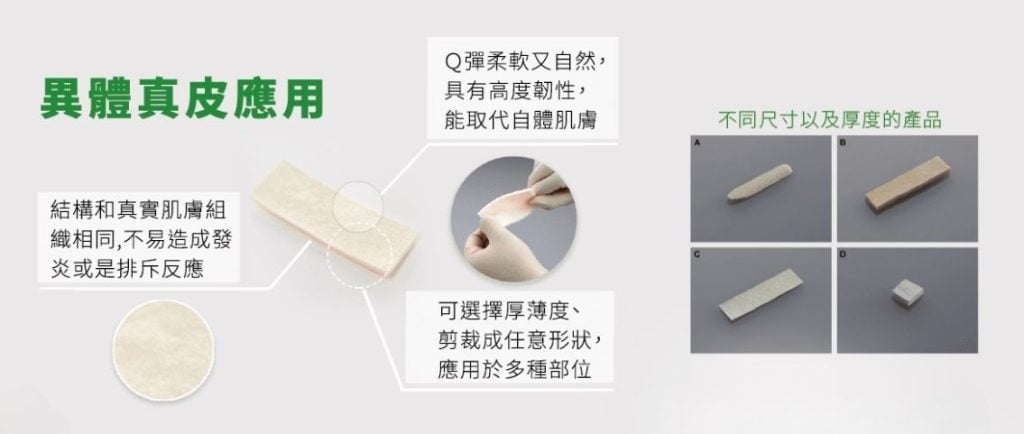 許維恩乳癌重建神助攻！醫師解析「異體真皮」關鍵角色