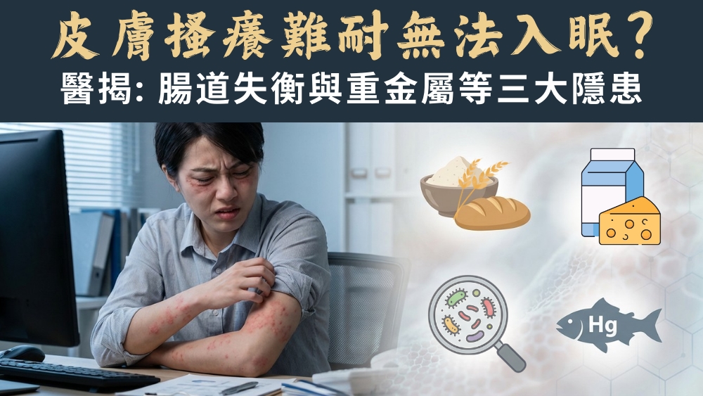 慢性蕁麻疹不止皮膚癢？醫師揭腸道失衡與重金屬等三大隱患