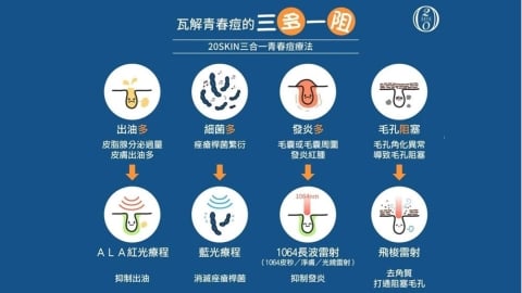 粉刺怎麼清?醫師教你正確處理方式避免毛孔粗大