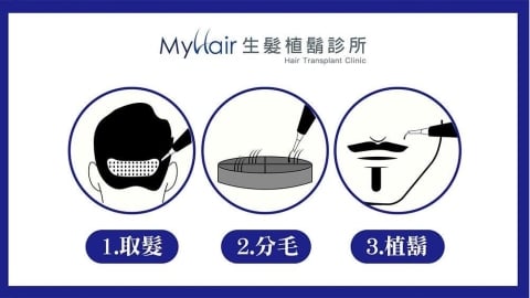 鬍型塑造如何評估？醫師解析植鬍療程與常見問題