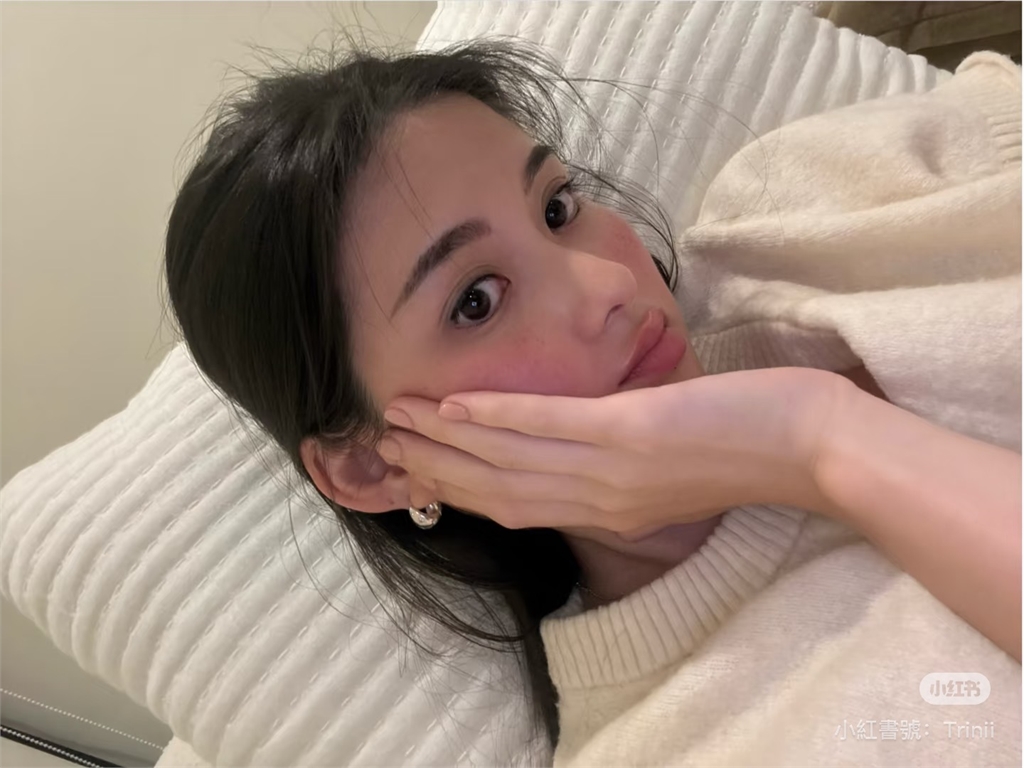 孫芸芸愛女卸妝後臉頰突「一片紅」　玫瑰斑發作她親吐「真實病情」