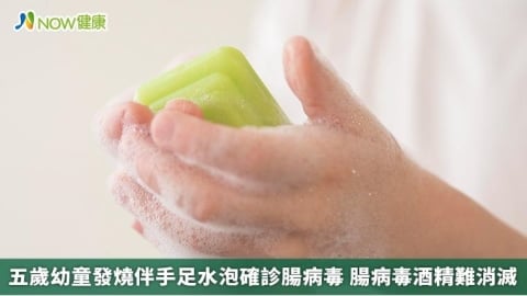 五歲幼童發燒伴手足水泡確診腸病毒 腸病毒酒精難消滅