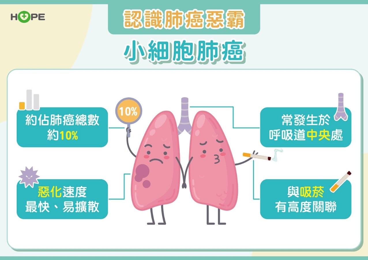 肺癌惡霸—小細胞肺癌存活率不到2%  積極治療突破瓶頸！