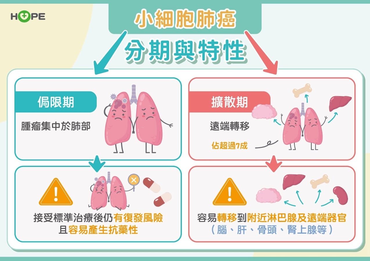 肺癌惡霸—小細胞肺癌存活率不到2%  積極治療突破瓶頸！