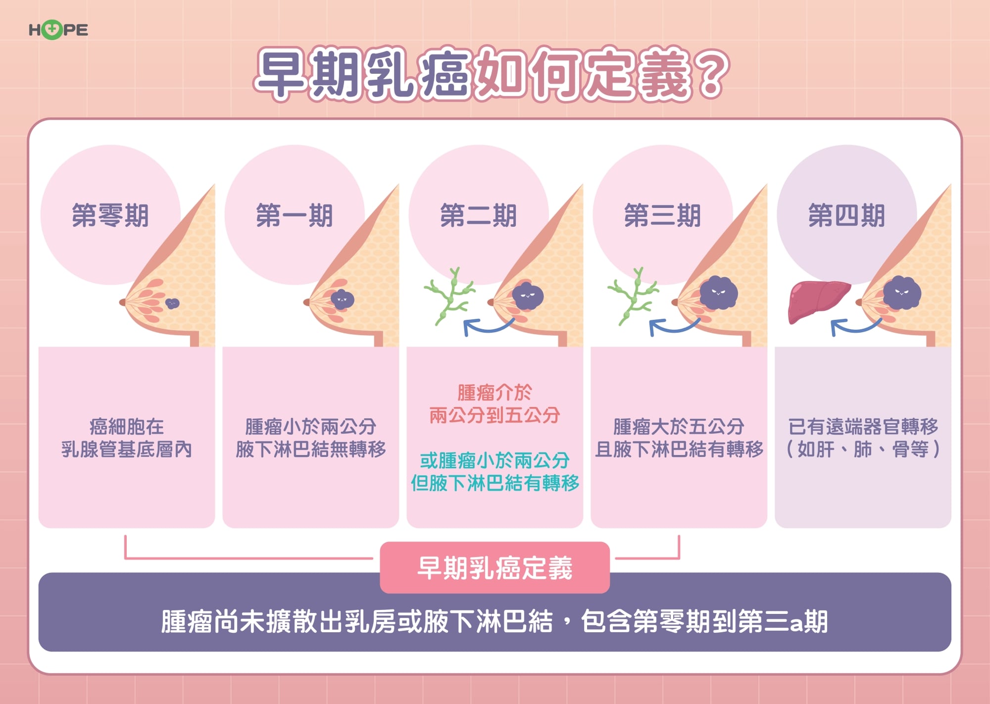 標靶藥物翻轉命運！HER2陽性早期乳癌積極治療抗復發　有機會痊癒